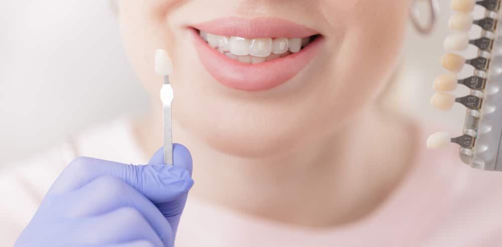 Cosmetic Dentistry Dorchester